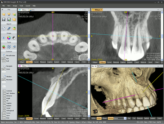 DICOM Insight